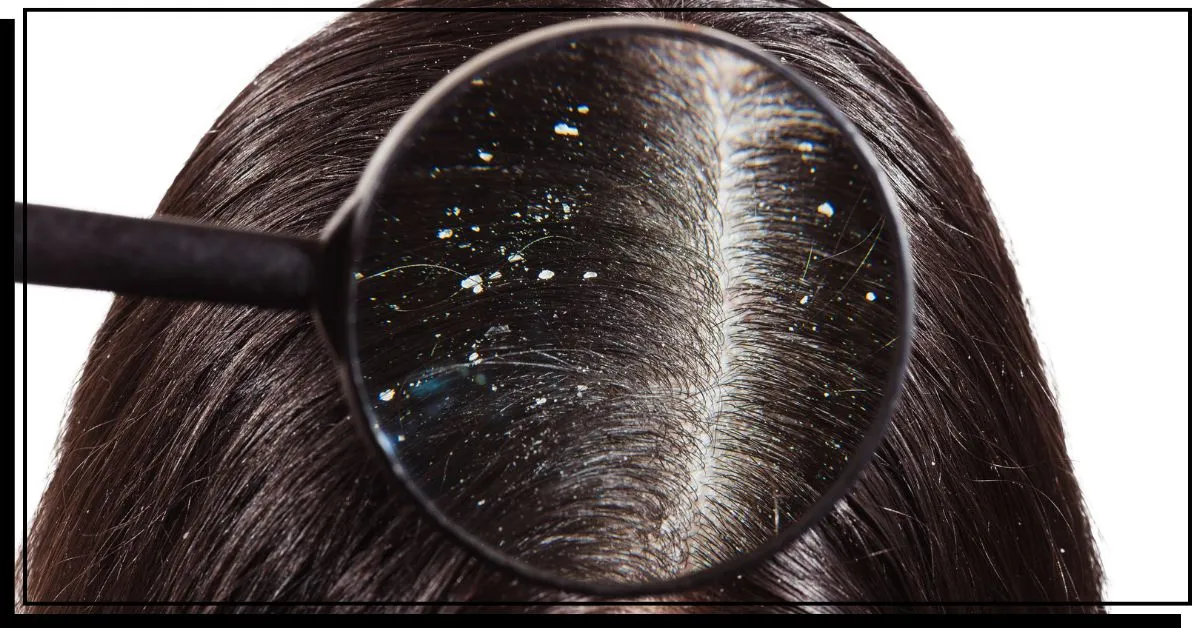 Oppbygging på håret' title=