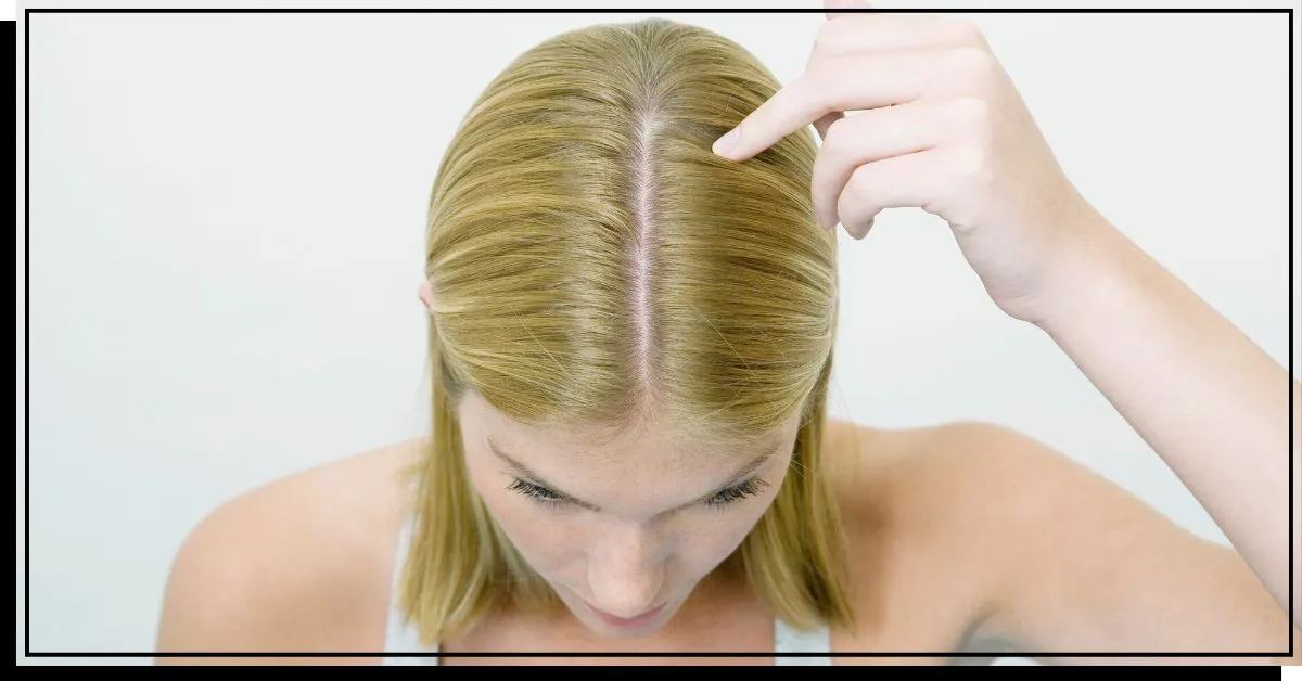 Cabelo curto com couro cabeludo saudável' title=