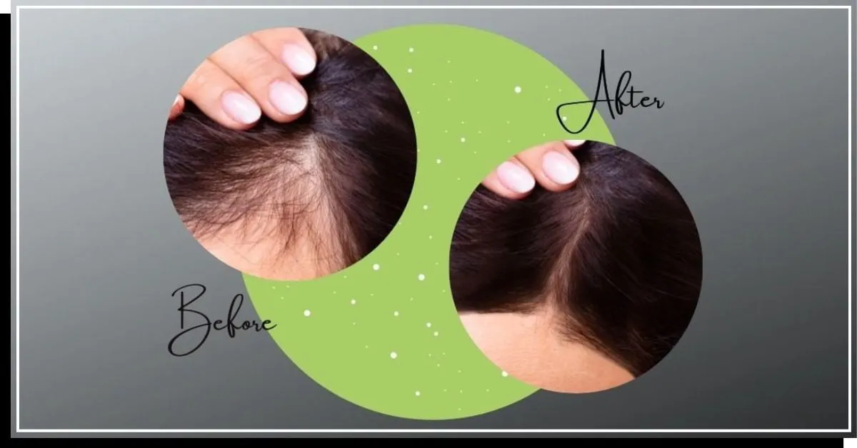 Před a po ošetření vlasů rozmarýnovou vodou' title=