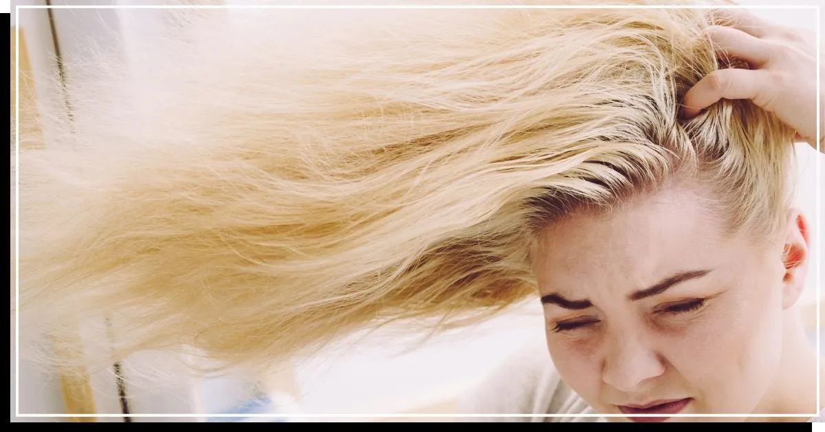 Cabello fino y cuero cabelludo graso con puntas secas y dañadas.' title=