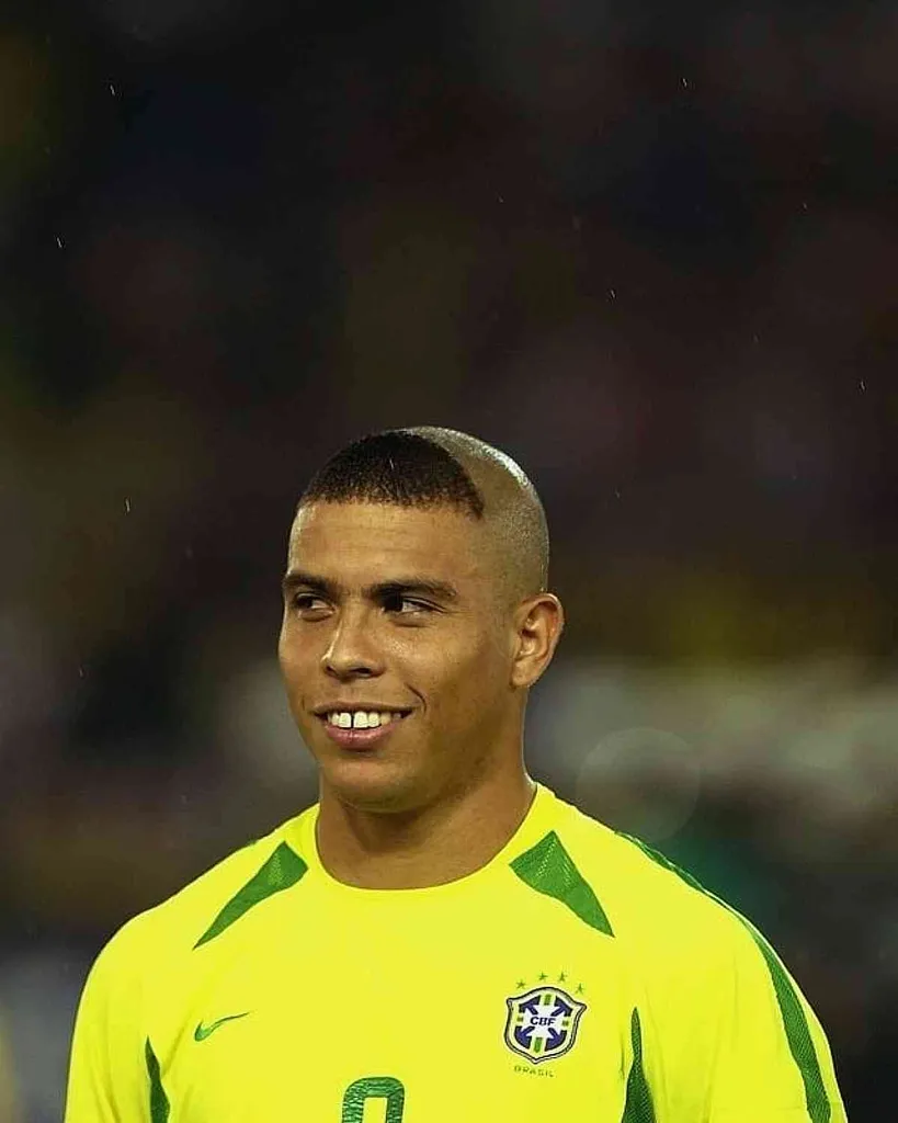 Priekšpagalma bārkstis' title=