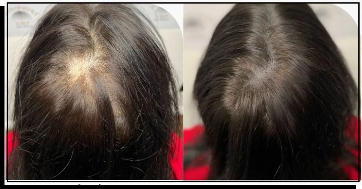 Pred a po účinkoch úpravy cibuľovej vody' title=