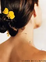 Acu-joga: akupresūra un jogas terapija