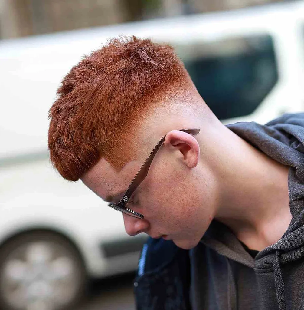 Scolorimento della pelle per un uomo dai capelli rossi naturali' title=