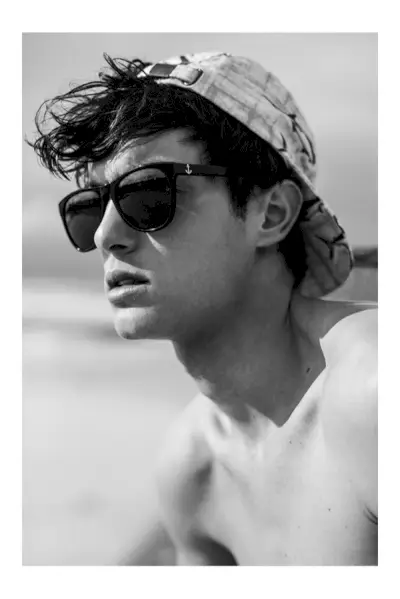 quemaduras soleadas 00021