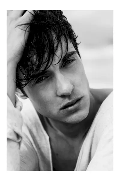 quemaduras soleadas 0008