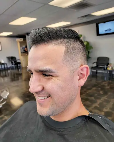 Receding Hairline with Comb Over