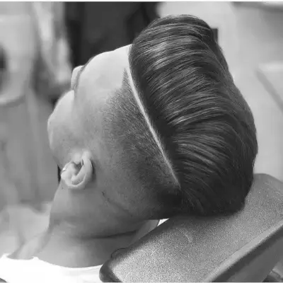 Undercut with long surgical line