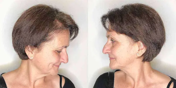 Wash-And-Wear Wedge Pixie Bob for Women 50 and Over